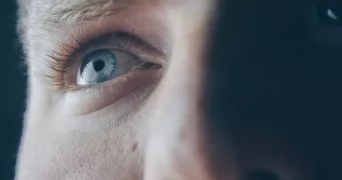 Signs of Aging Eyes