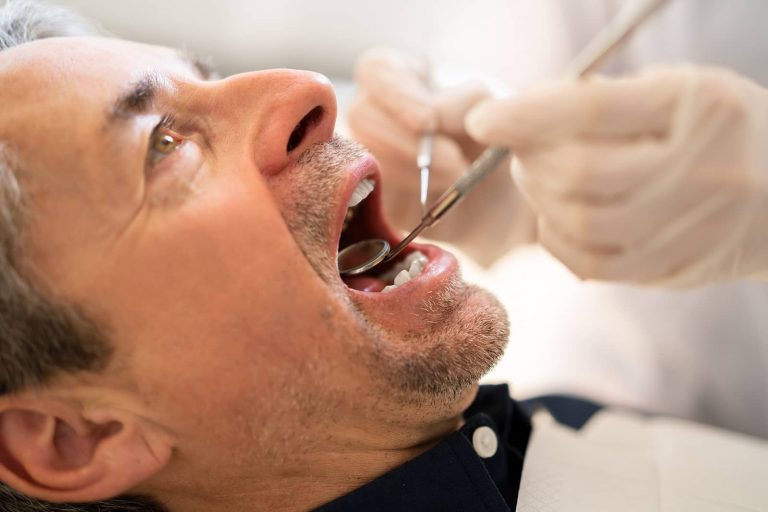 Medicare Coverage for Dental Care Services & Treatments