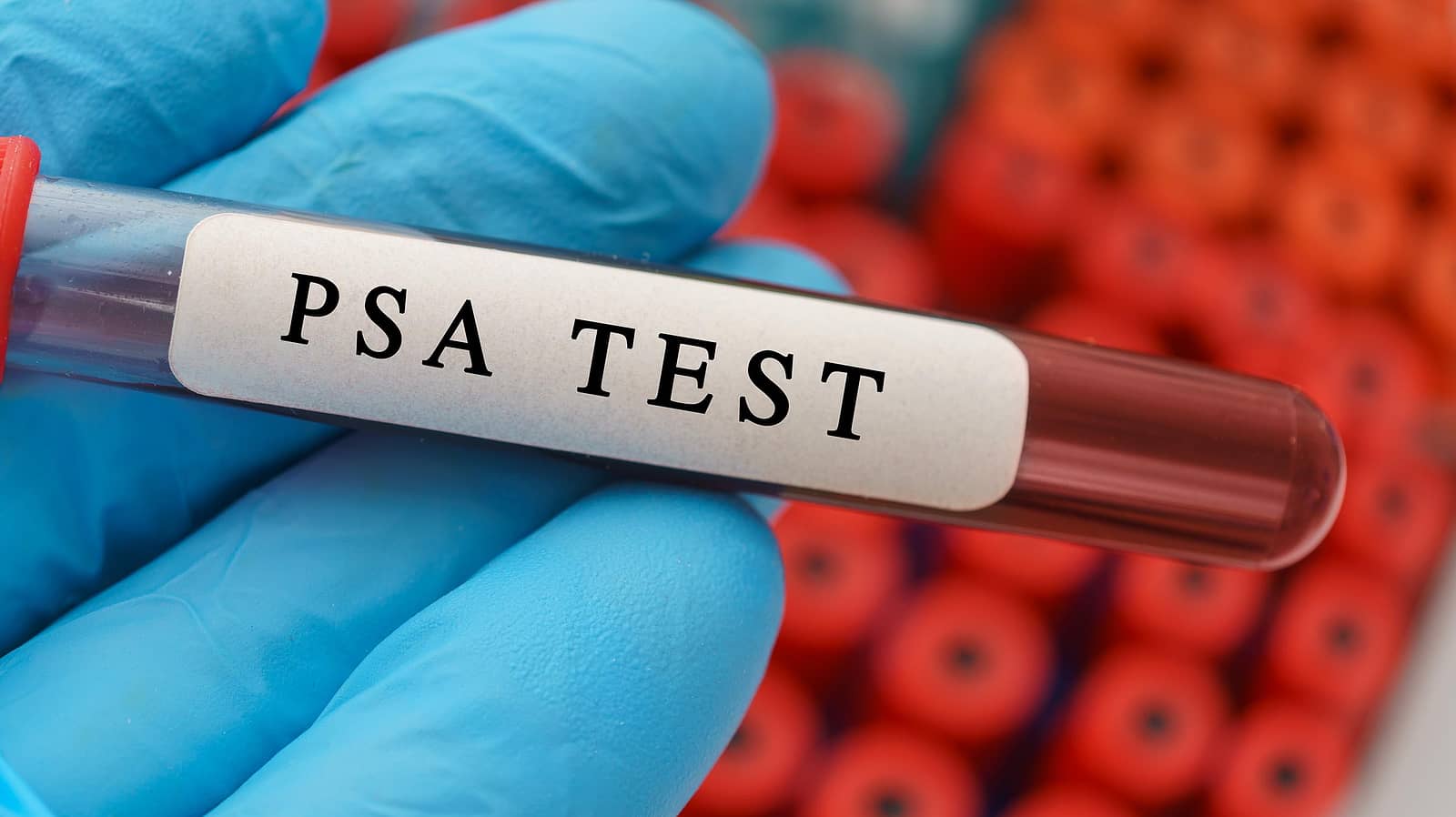 Medicare Coverage Prostate-Specific Antigen (PSA) Tests