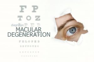 Medicare Coverage for Age-Related Macular Degeneration