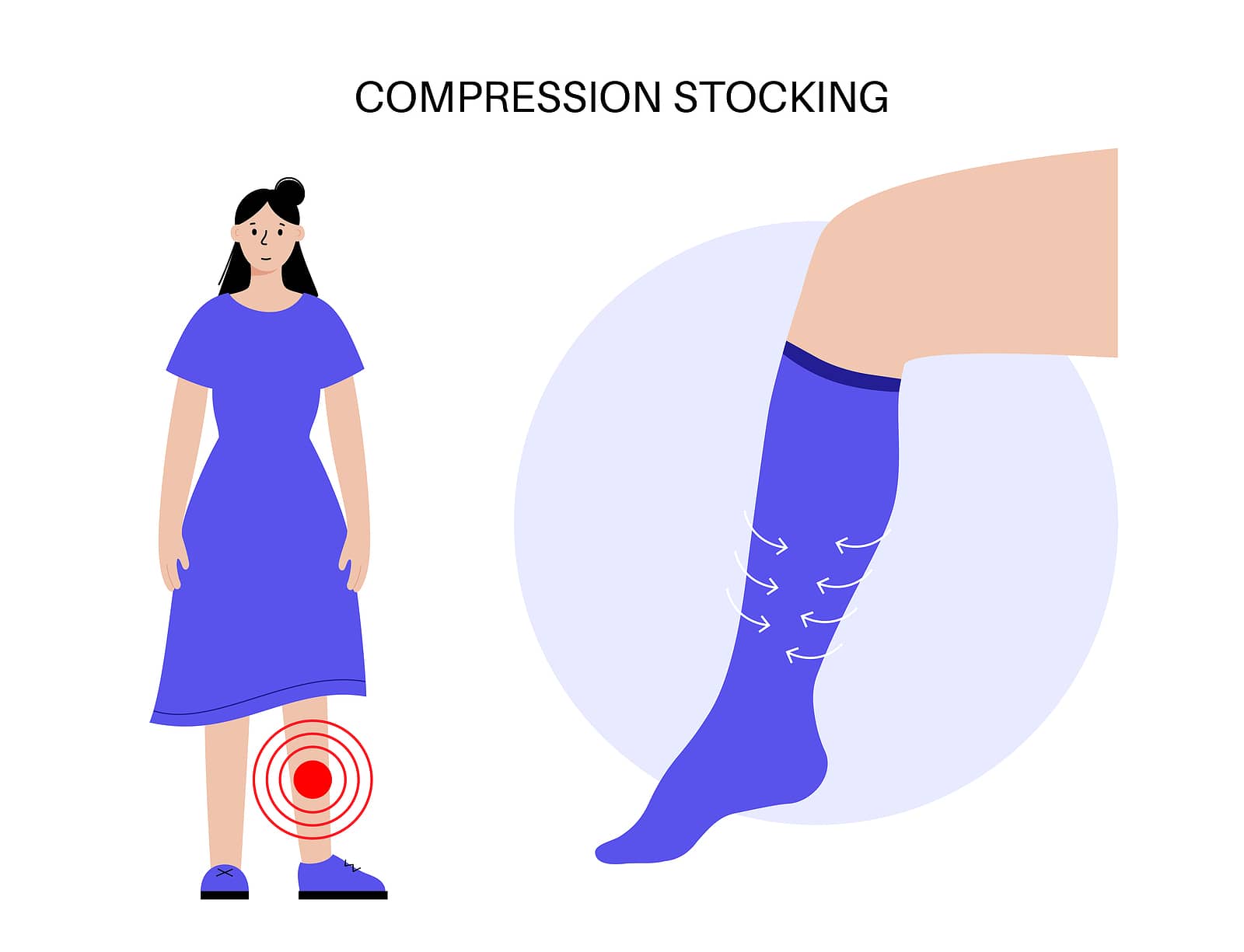 Medicare Coverage for Compression Socks